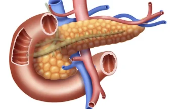 Kreon vagy Panzytrat: melyik enzimkészítményt válasszuk?