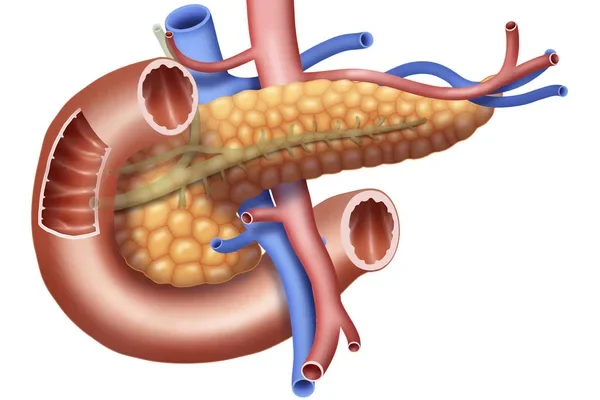 Kreon vagy Panzytrat: melyik enzimkészítményt válasszuk?